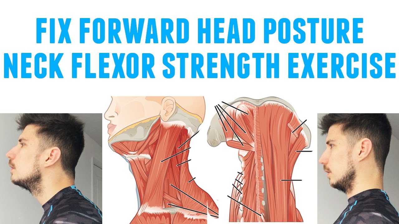 Correcting Forward Head Posture for Better Alignment